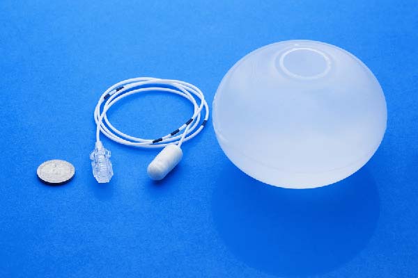 gastric balloon mallorca weight cinib